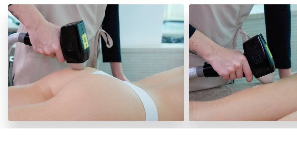 Aparat remodelare corporala Q Collagen Synergy