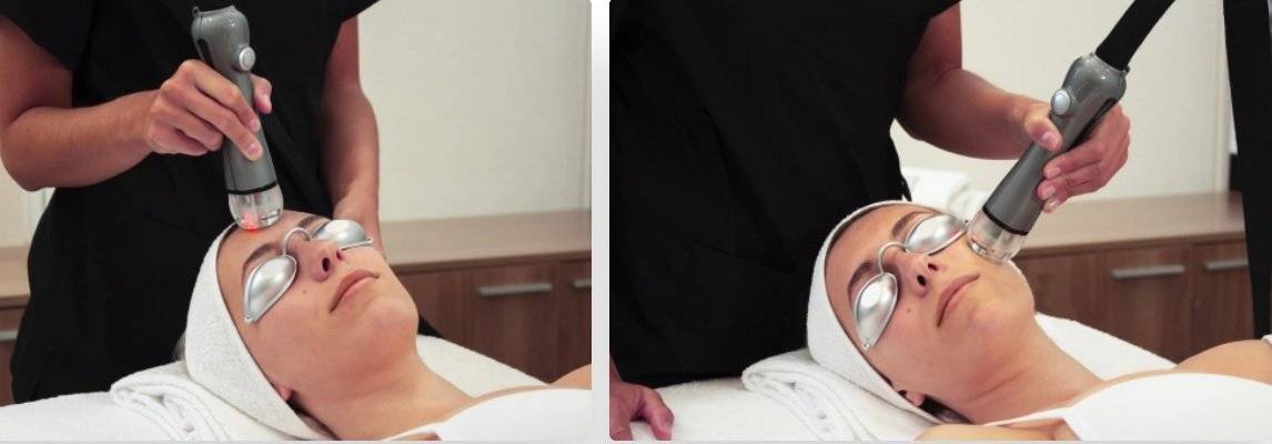 Aparat tratament facial Q ReGenesys