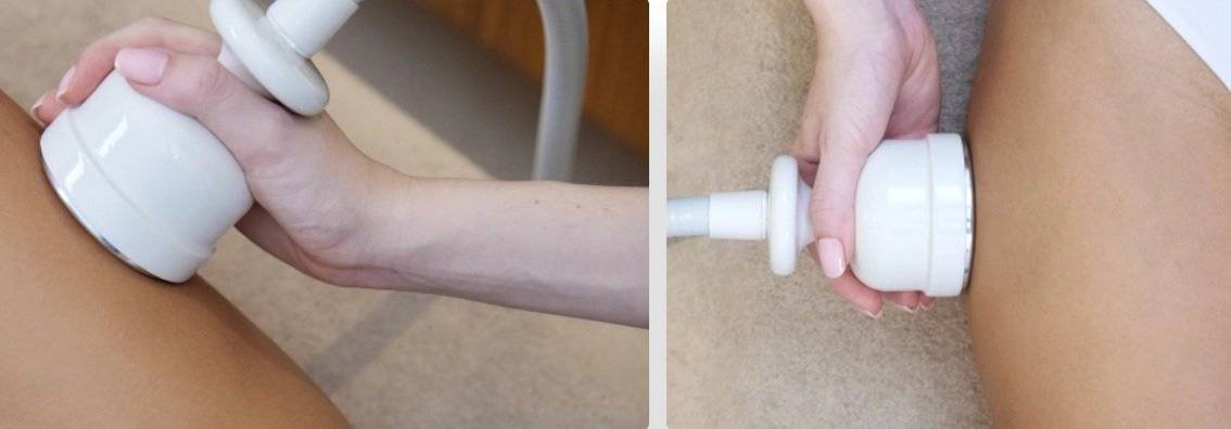 Aparatura ingrijire faciala Q Cold Recovery System